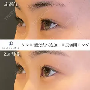 LOUIS CLINIC 二子玉川院【ルイクリニック】 小松 塁医師の症例