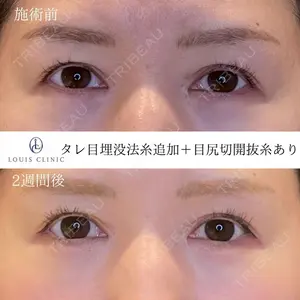 LOUIS CLINIC 二子玉川院【ルイクリニック】 小松 塁医師の症例