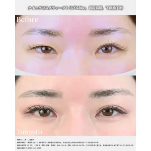湘南美容クリニック 名古屋院 山本 高士医師の症例