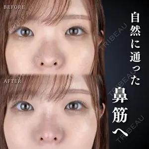 ルラ美容クリニック 千葉院 / ルラスキンクリニック 千葉院 下川 洋輝医師の症例