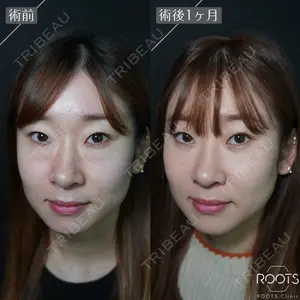 ROOTS Clinic 郭 天元医師の症例