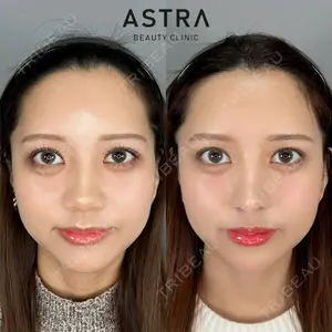 ASTRA BEAUTY CLINIC 塩満 惠子医師の症例