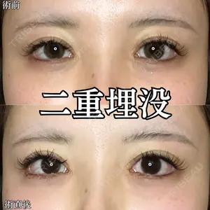形成外科と美容外科のクリニック池袋 春日 航医師の症例