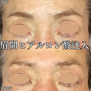 形成外科と美容外科のクリニック池袋 春日 航医師の症例