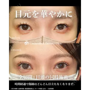 シンデレラ＆ダヴィンチクリニック 宮田 洋佑医師の症例