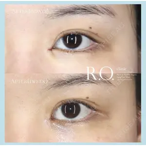 R.O.clinic 呂 秀彦医師の症例
