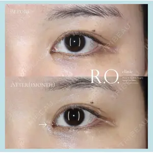 R.O.clinic 呂 秀彦医師の症例