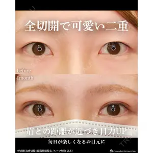 シンデレラ＆ダヴィンチクリニック 宮田 洋佑医師の症例