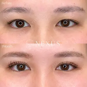NEXUS CLINIC 横田 智子医師の症例