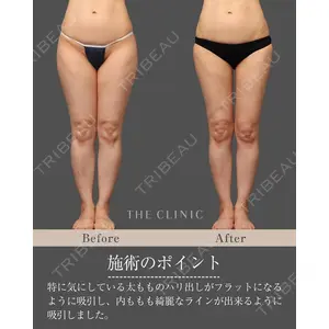 THE CLINIC（ザ・クリニック） 東京院 帯包 雄次郎医師の症例