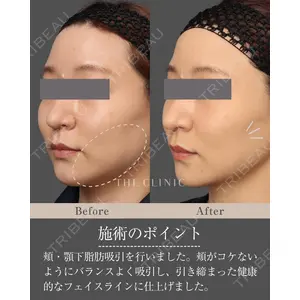 THE CLINIC（ザ・クリニック） 東京院 吉塚 将昭医師の症例