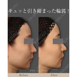 THE CLINIC（ザ・クリニック） 東京院 吉塚 将昭医師の症例