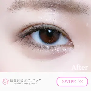 仙台N美容クリニック 小阪 捺稀医師の症例