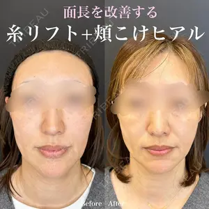 ルラ美容クリニック 名古屋栄院 関戸 優医師の症例