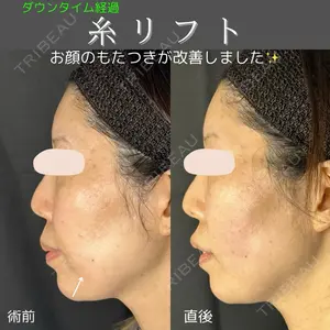ルラ美容クリニック 仙台院の症例