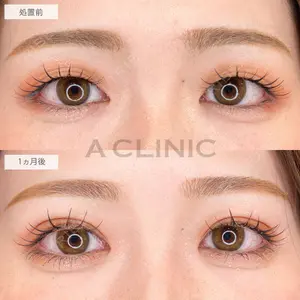 A CLINIC（エークリニック） 大阪院 木家 佑理子医師の症例