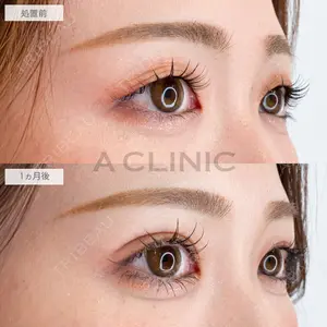 A CLINIC（エークリニック） 大阪院 木家 佑理子医師の症例
