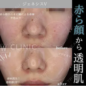 Wクリニック 梅田院の症例