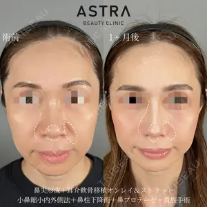ASTRA BEAUTY CLINIC 塩満 惠子医師の症例