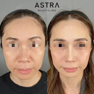 ASTRA BEAUTY CLINIC 塩満 惠子医師の症例