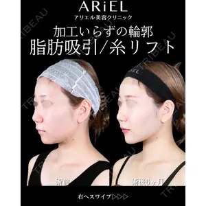アリエル美容クリニック 大宮院 鈴木　桂介医師の症例