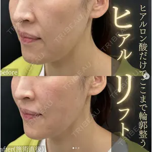 湘南美容クリニック 名古屋駅本院 伊藤 整医師の症例