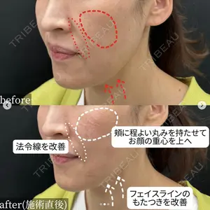 湘南美容クリニック 名古屋駅本院 伊藤 整医師の症例