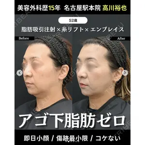 湘南美容クリニック 名古屋駅本院 高川 裕也医師の症例