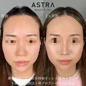 ASTRA BEAUTY CLINIC 塩満 惠子医師の症例
