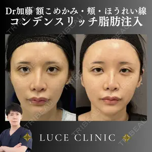 ルーチェクリニック 銀座院 加藤晴之輔医師の症例