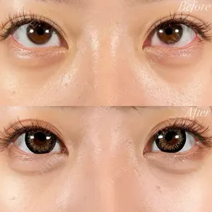 R Beauty CLINIC 名古屋院 木村 尚大医師の症例