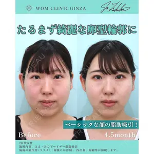 WOM CLINIC GINZA （ワム クリニック ギンザ） 深堀 純也医師の症例