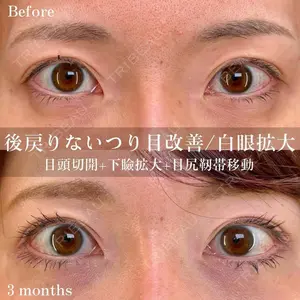 eクリニック 金沢本院の症例