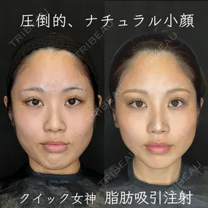 Wing clinic 豊中駅前院 速水 翼医師の症例