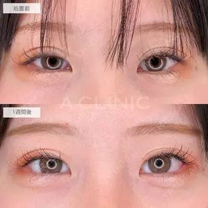 A CLINIC（エークリニック） 大阪院 田窪 賢志郎医師の症例