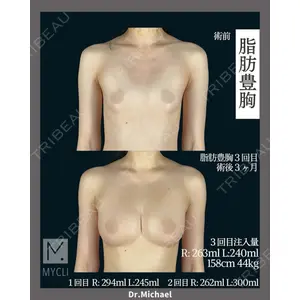 MYCLI【マイクリ】 本田マイケル武史医師の症例