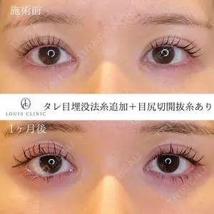 LOUIS CLINIC 二子玉川院【ルイクリニック】 小松 塁医師の症例