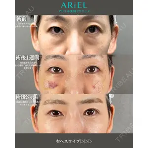 アリエル美容クリニック 大宮院 鈴木　桂介医師の症例