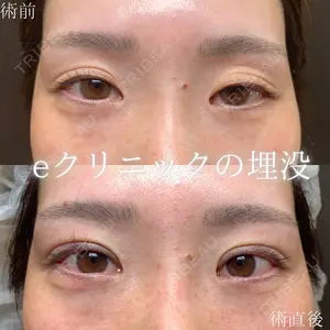 eクリニック 大阪梅田 西日本統括院 江﨑 正俊医師の症例