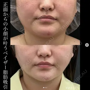 湘南美容クリニック 名古屋駅本院 豊嶋 沙良医師の症例