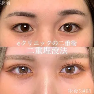 eクリニック 大阪梅田 西日本統括院 江﨑 正俊医師の症例