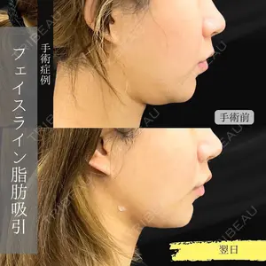 LOCHIC CLINIC GINZA【ロシッククリニック銀座】 小山 麻衣医師の症例