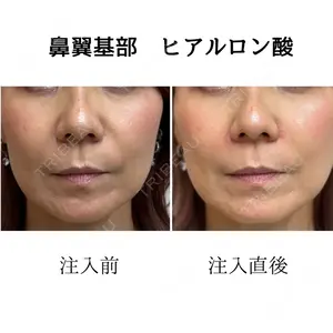 おおたかの森ビューティークリニックの症例