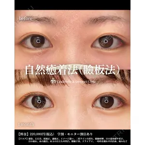シンデレラ＆ダヴィンチクリニック 宮田 洋佑医師の症例