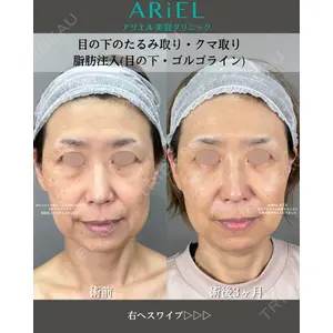 アリエル美容クリニック 大宮院 鈴木　桂介医師の症例