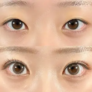R Beauty CLINIC 名古屋院 木村 尚大医師の症例