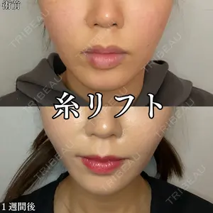 形成外科と美容外科のクリニック池袋 春日 航医師の症例
