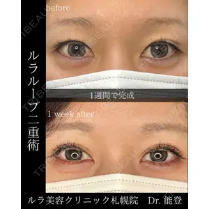 ルラ美容クリニック 札幌院 能登 貴弘医師の症例