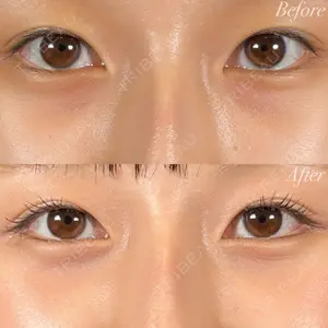 R Beauty CLINIC 名古屋院 木村 尚大医師の症例