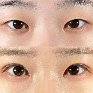R Beauty CLINIC 名古屋院 木村 尚大医師の症例